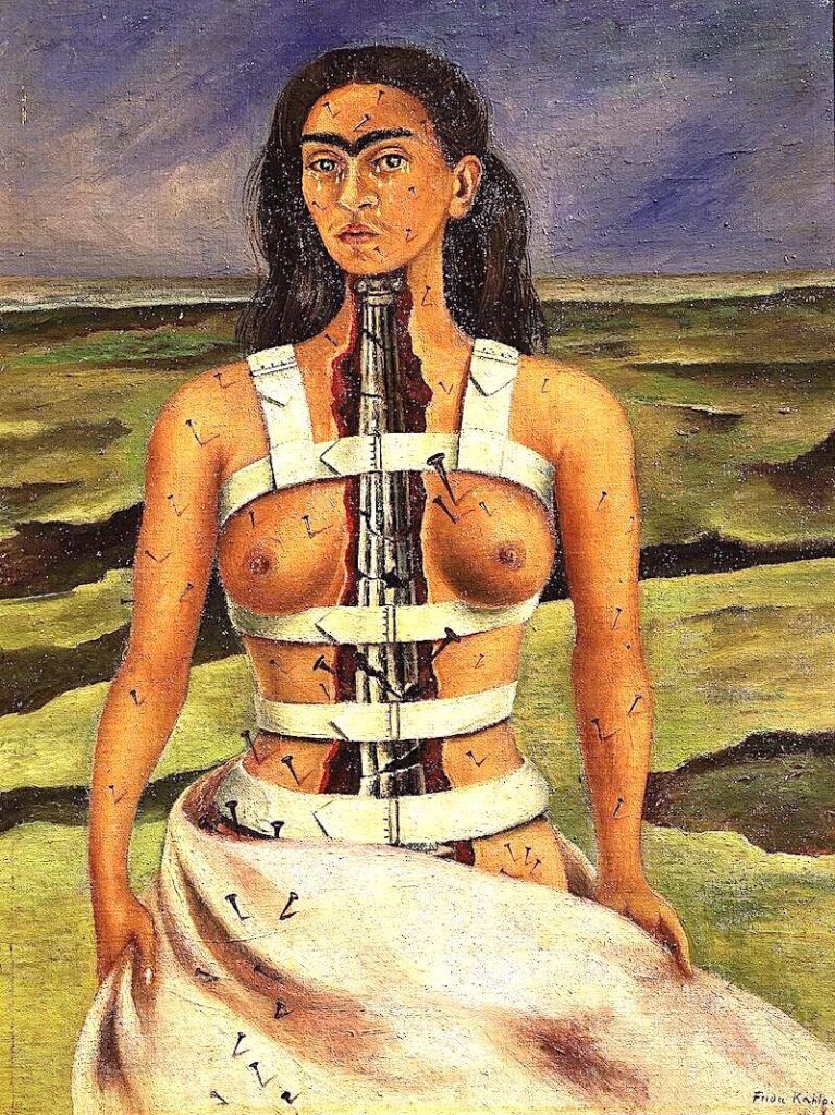 Frida Kahlo in a surgical brace with a shattered column replacing her spine, symbolizing her strength amidst suffering.